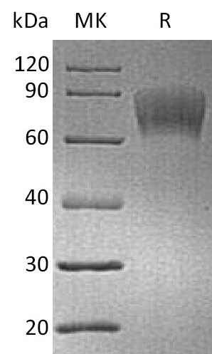Biotinylated Human CD30 +SDS-PAGE.jpg
